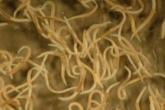 Roundworm (Nematoda)